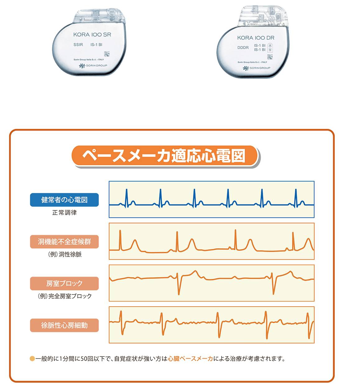 ペースメーカー